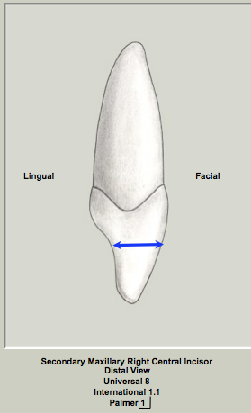 Ext Morph Mx Central Distal 2.png